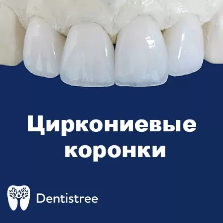  Стоматологічна клініка в Сумах Dentistree dioksida_cirkoniya-min.jpg