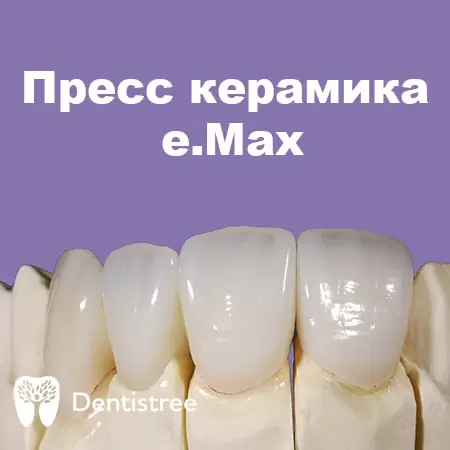  Стоматологічна клініка в Сумах Dentistree emaxpress1-min.jpg